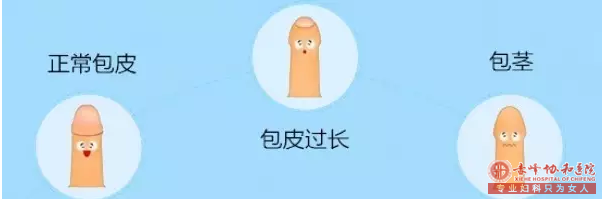 金华婺城区婺城区红山区割包皮有年龄限制吗？