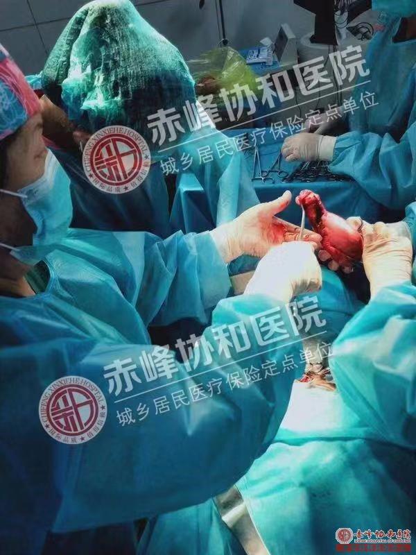 金华宁城县子宫肌瘤会影响你的生育力吗？ 